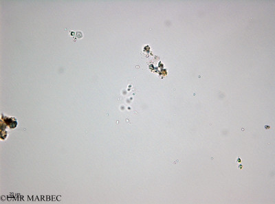 phyto/Thau_Lagoon/THAU_station1/OSU_plancton 2013/Pseudopedinella sp (40x -140211 -2)(copy)_thumb.jpg